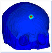 animation of skull stress propogation